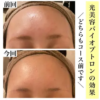 Bellesthe (ベルエステ)のエステ・リラクイメージ