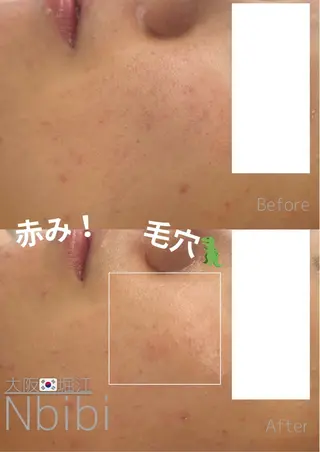 韓国🇰🇷価格 サロン_Nbibiのエステ・リラクイメージ