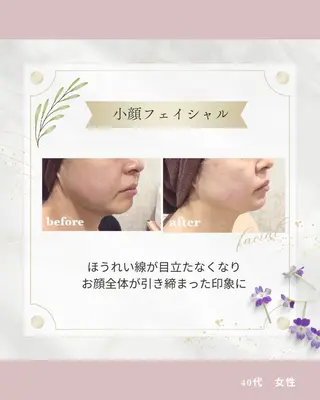 トータルビューティー addissimoのエステ・リラクイメージ