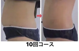 横浜エステサロン R-ing リングのエステ・リラクイメージ