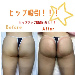 エルフラージュ 銀座店のエステ・リラクイメージ