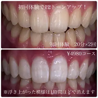 ホワイトニングルーム　川崎店所属・ホワイトニング ルーム　川崎店のその他イメージ