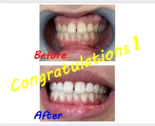 セルフホワイトニングサロン　ラヴィアン所属・ホワイトニングサロン La vie enのその他イメージ