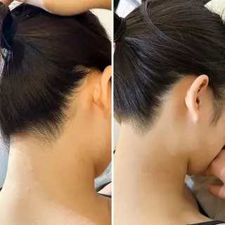 うなじ脱毛/美肌脱毛 LABELのエステ・リラクイメージ