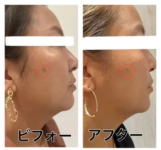 脱毛フェイシャル痩身 エリア最安👑永野舞のエステ・リラクイメージ