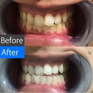 ショート パーマ マツエク・マツパ アイブロウ ヘアアレンジ メンズ キッズ ネイル カラー 中目黒 ホワイトニングサロンのその他イメージ