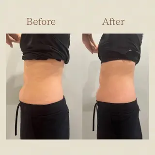 お腹痩せエステ Flat BELLY 恵比寿所属・【腸もみ/脂肪冷却】 お腹エステ/恵比寿のエステ・リラクイメージ