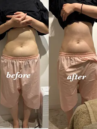 腸活サポート みなみののエステ・リラクイメージ