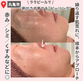 【LEPUS】 sekiのエステ・リラクイメージ