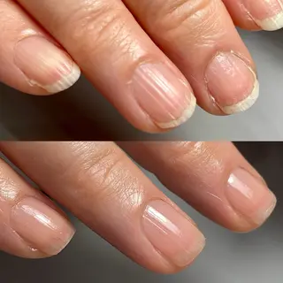 ネイル Aim* 深爪・自爪育成専門店のネイルデザイン