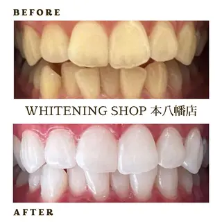メンズ ホワイトニング ショップ本八幡店のエステ・リラクイメージ