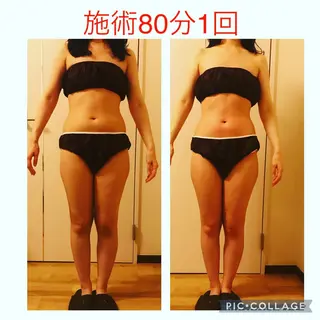 セミロング カラー パーマ ヘアアレンジ メンズ キッズ ネイル マツエク・マツパ アイブロウ アニメ,Vオタク× 即効痩せエステサロンのエステ・リラクイメージ