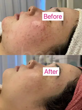 べアール所属・小顔/毛穴/白玉肌 salon bealのその他イメージ