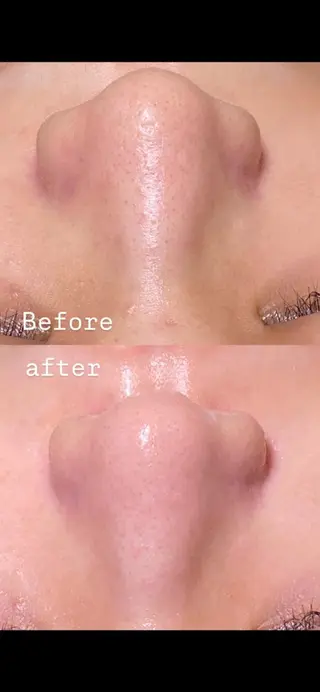 NICOLAUGH/ 村松【小顔.ボディ】のエステ・リラクイメージ