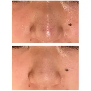 触れたくなる モテ肌へ...❤︎のエステ・リラクイメージ