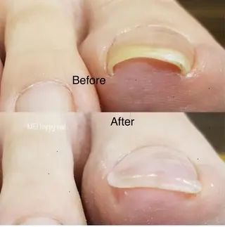 ネイル 北浦和 自爪育成ケアのネイルデザイン