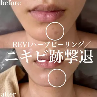 WHITE AQUA 北千住店のエステ・リラクイメージ