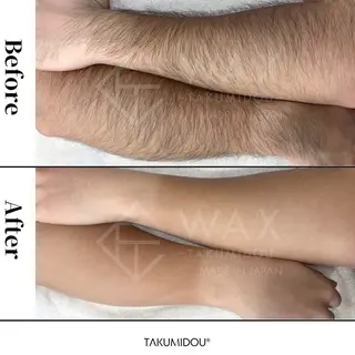 JYUNESU所属・眠れるワックス脱毛 ・銀座のエステ・リラクイメージ