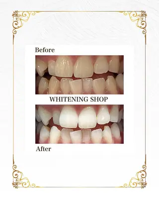 ホワイトニングショップ静岡葵区店所属・ホワイトニング ショップ静岡葵区店のその他イメージ