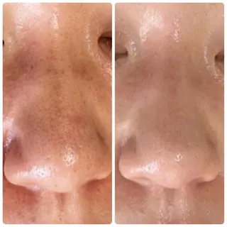 De I'm トータルビューティーサロン所属・COCO beautyサロンのエステ・リラクイメージ