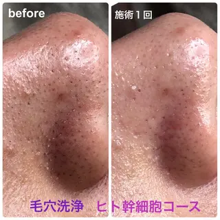 メンズ beauty salon Primus所属・Primus ﾌﾟﾘﾑｽのマツエク・マツパデザイン