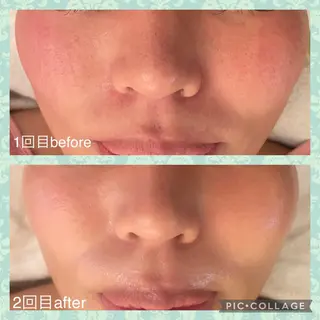 Serenity salonのエステ・リラクイメージ