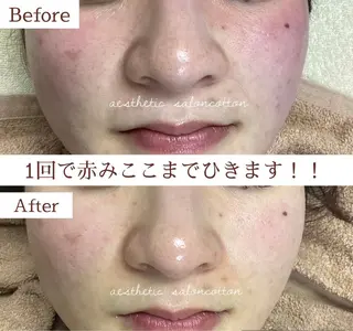 都度払い 肌質改善専門サロンのエステ・リラクイメージ