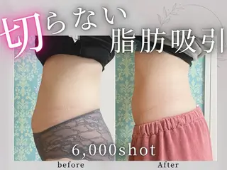 小顔矯正専門店 【RED】池田のエステ・リラクイメージ