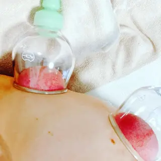 鍼灸サロン　MARINOTE所属・鍼灸サロン MARINOTEのエステ・リラクイメージ