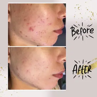 ピーリング専門店 Belluteのエステ・リラクイメージ