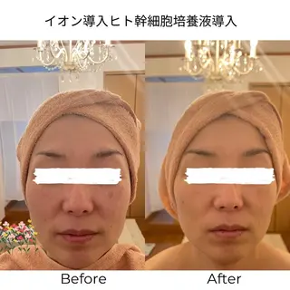 MA CHÉRIE所属・体質別痩身&小顔 MA CHÉRIEのエステ・リラクイメージ