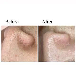 ニキビ/敏感肌/乾燥 Lilyauraのエステ・リラクイメージ