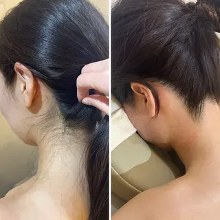 うなじ脱毛/美肌脱毛 LABELのエステ・リラクイメージ