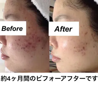 都度払い肌質改善 &脱毛Blancheのエステ・リラクイメージ