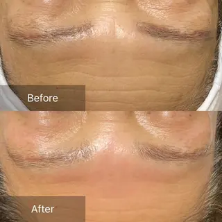 産毛専門店 Bittoのエステ・リラクイメージ