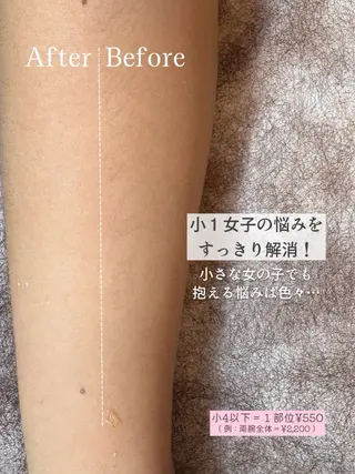 Hit. シュガーリング豊橋のエステ・リラクイメージ