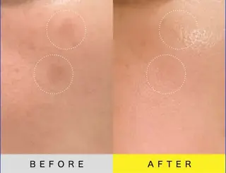 salon merci和泉のエステ・リラクイメージ