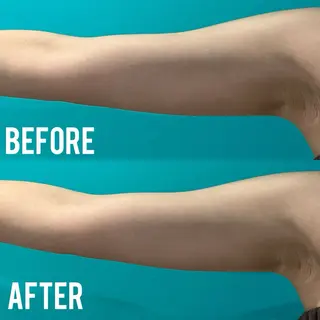 MEITY新宿所属・小顔、毛穴ケア MEITY新宿のエステ・リラクイメージ