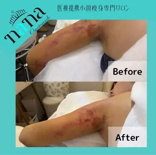 小顔痩身インディバ Nana表参道のエステ・リラクイメージ