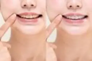 ecxia white 高田馬場所属・セルフホワイトニング エクシア 高田馬場のその他イメージ