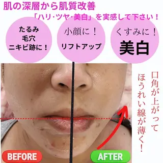 akua...痩身・ 脱毛・ホワイトニングのその他イメージ