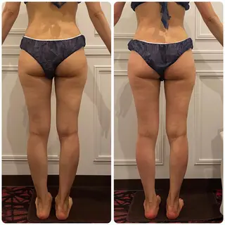 立体小顔×艶肌×美ボ ディ似合わせ施術 岡のエステ・リラクイメージ