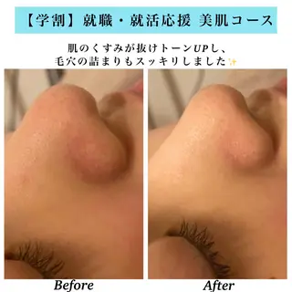 Bellesthe (ベルエステ)のエステ・リラクイメージ