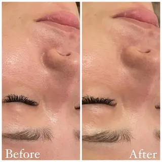 ✨美肌水光✨ アトリエリュバンのエステ・リラクイメージ