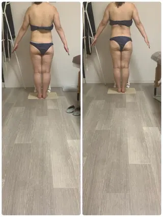 美ボディメイクサロン　only one body所属・桑田 里美のエステ・リラクイメージ