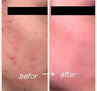 自爪育成ネイルサロン ココリュバンのネイルデザイン