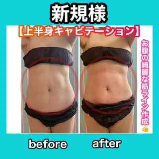 痩身/脱毛/ネイル HARUKAのエステ・リラクイメージ