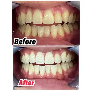 メンズ キッズ ネイル マツエク・マツパ アイブロウ プラチナムビューティー柏所属・【歯科提携】柏ホワイ トニングスタイルのその他イメージ