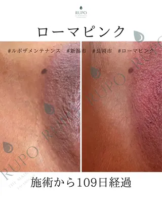 医療提携認定サロン　RUPO THE MAINTENANCE新潟店【ローマピンク/ララピール】所属・オーナー Nanjoのエステ・リラクイメージ