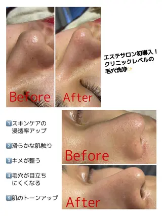 ハーブピーリング・毛穴ケア専門サロンSalon de LENA所属・ハーブピーリング 専門店/名古屋駅前店のエステ・リラクイメージ